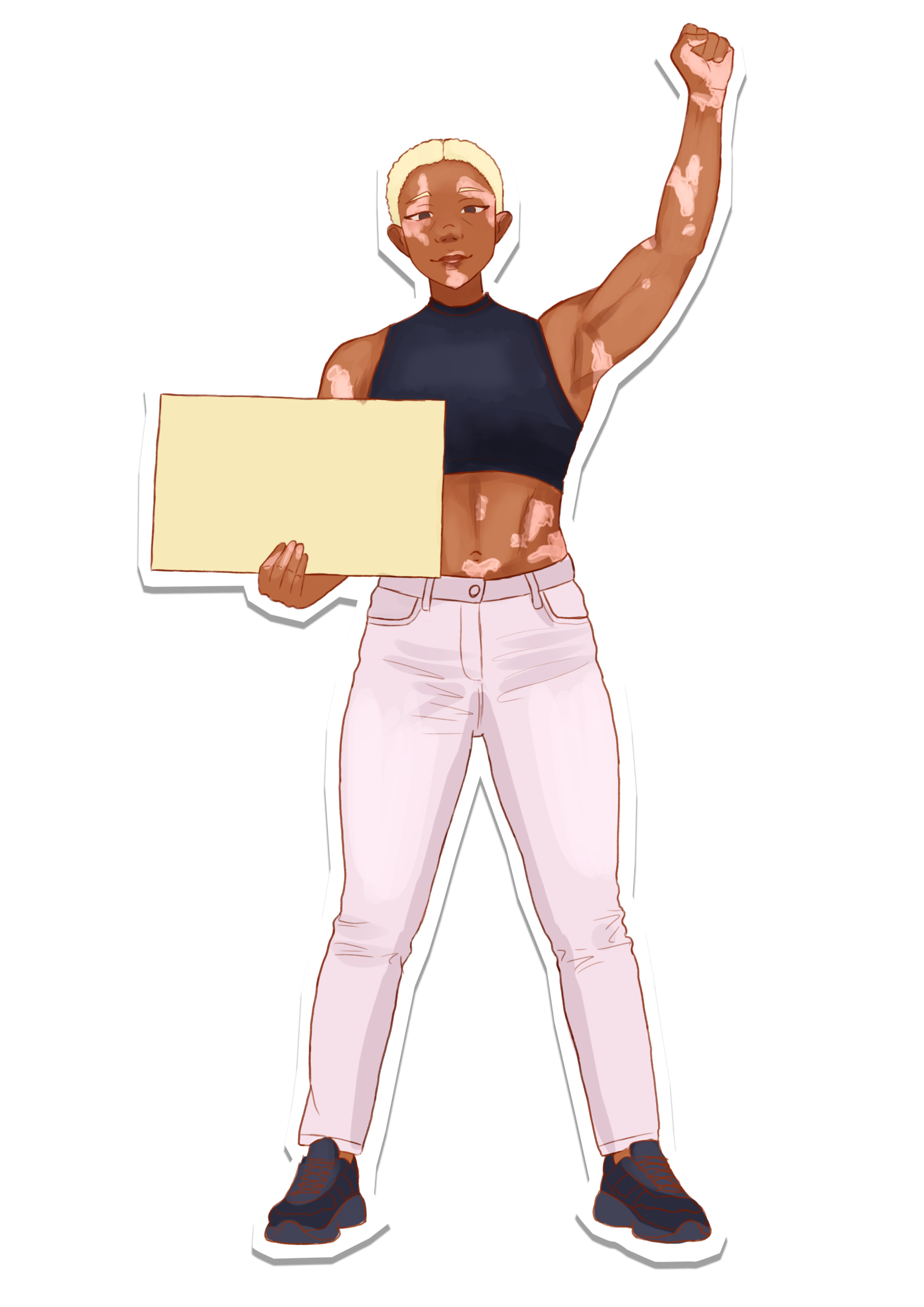 Woman with vitiligo